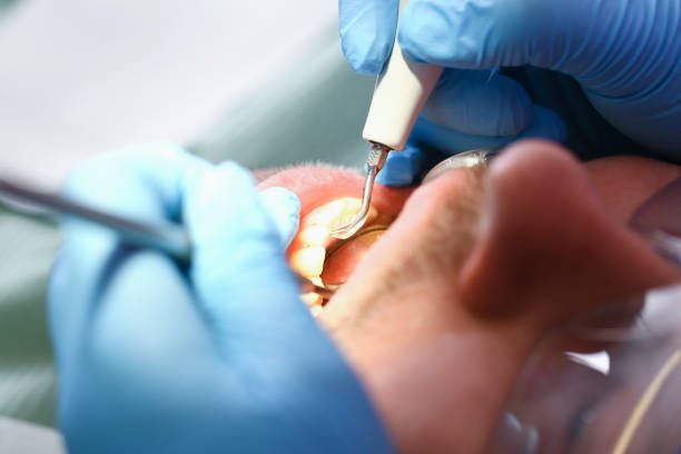 Best Broken or Chipped Tooth Repair in Elm Creek, TX